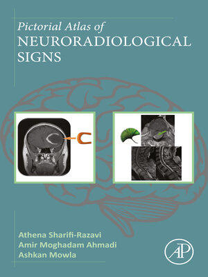 cover image of Pictorial Atlas of Neuroradiological Signs